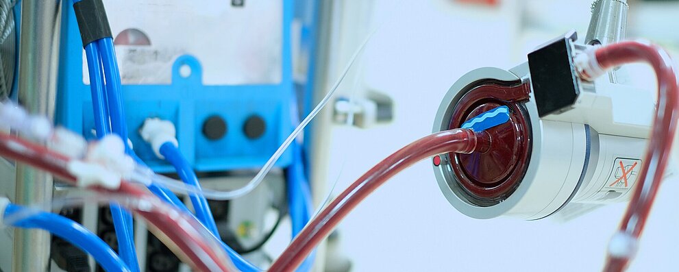 Making Patient Monitoring More Intelligent with Ultrasound