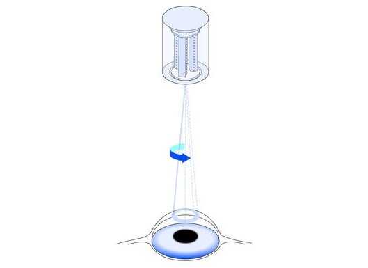 High-Precision Drives in Ophthalmic Surgery